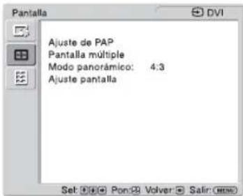 SONY GXDL52H1 - Pantalla - 1
