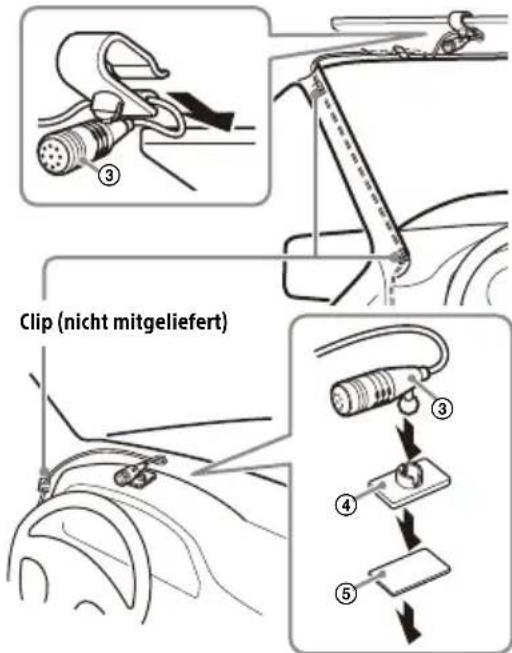 SONY XAVAX3250 - Installieren des Mikrofons - 1