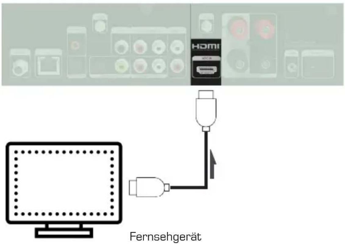 Imperial DABMAN i560 CD - Anschluss des Fernsehgerätes - 2