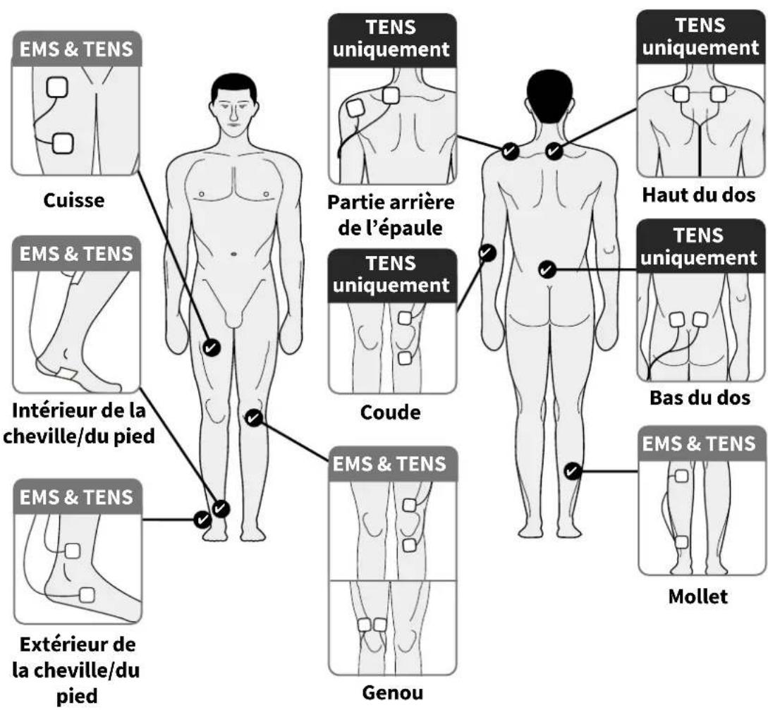 REVITIVE Medic Coach - Utilisation des electrodes corporelles - 2