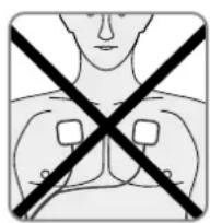 REVITIVE Medic Coach - Programme EMS Corps - 3