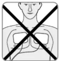 REVITIVE Medic Coach - Programme Genou Doux - 3