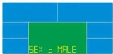 Skandika CardioCross Carbon Champ - Body Fat (Körperfettmessung) - 1