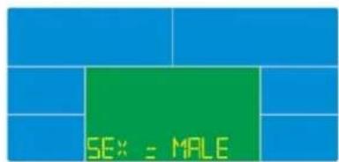 Skandika CardioCross Carbon Champ - Body Fat - 1