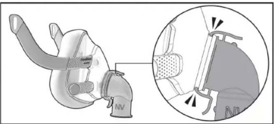 ResMed NV Elbow F20 - 拆卸 - 1
