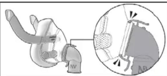 ResMed NV Elbow F20 - Penceraian - 1