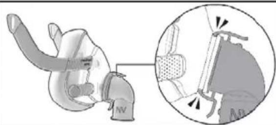 ResMed NV Elbow F20 - التفكيك - 1