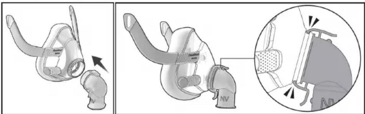 ResMed NV Elbow F20 - Montering - 1