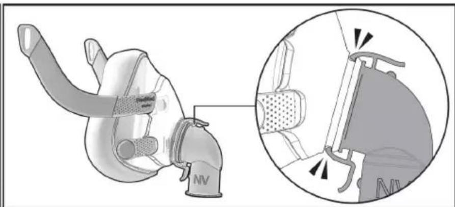 ResMed NV Elbow F20 - Разглобяване - 1