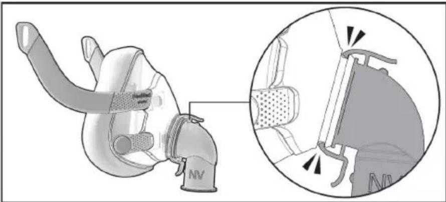 ResMed NV Elbow F20 - Sökme - 1