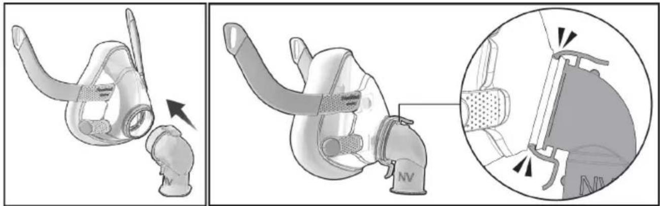 ResMed NV Elbow F20 - Assemblaggio - 1
