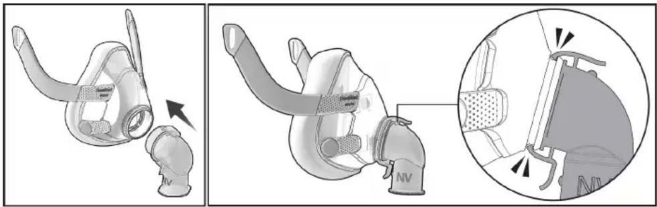 ResMed NV Elbow F20 - Montage - 1