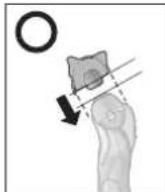 PANASONIC ESST2N - Fixation du support - 3