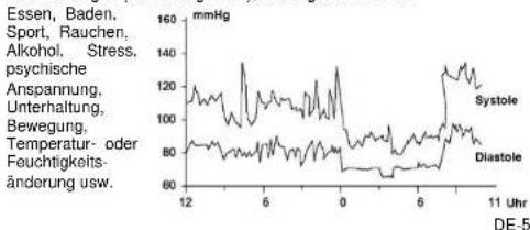 Scala SC 6750A - Schwankungen des Blutdrucks - 1