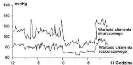 Scala SC 6750A - Zakładanie mankietu i pozycja pomiaru - 2