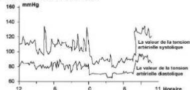 Scala SC 6750A - Variations de la tension artérielle - 1