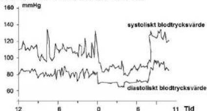 Scala SC 6750A - Variationer av blodtrycket - 1