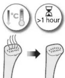 PHILIPS STE1010 - J 1 - 7