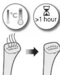 PHILIPS STE1010 - Utforelse av kalkrengjoringsprossessen - 2