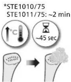 PHILIPS STE1010 - Slovensceina - 1