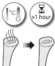 PHILIPS STE1010 - Pulizia e conservazione del sistema di stiratura a vapore verticale - 2