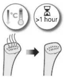 PHILIPS STE1010 - Membersihkan dan menyimpan penstim dirian - 2
