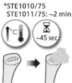 PHILIPS STE1010 - Alterar as regulacoes de vapor - 3