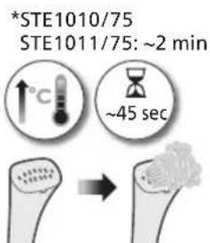 PHILIPS STE1010 - Polski - 1
