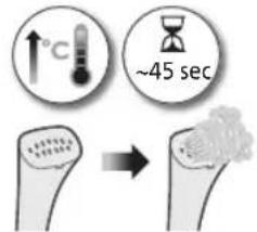 PHILIPS STE1010 - 3miHa HanaStyBaHb nap - 4