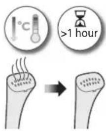 PHILIPS STE1010 - Pärast katlakivi eemaldamist - 2