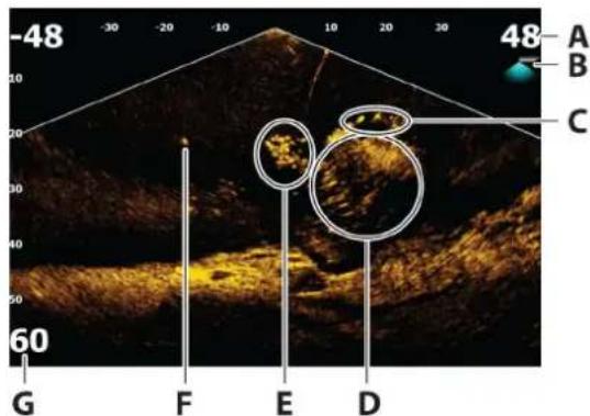 SIMRAD NSS evo3S - Fenêtre Down ActiveTarget - 1