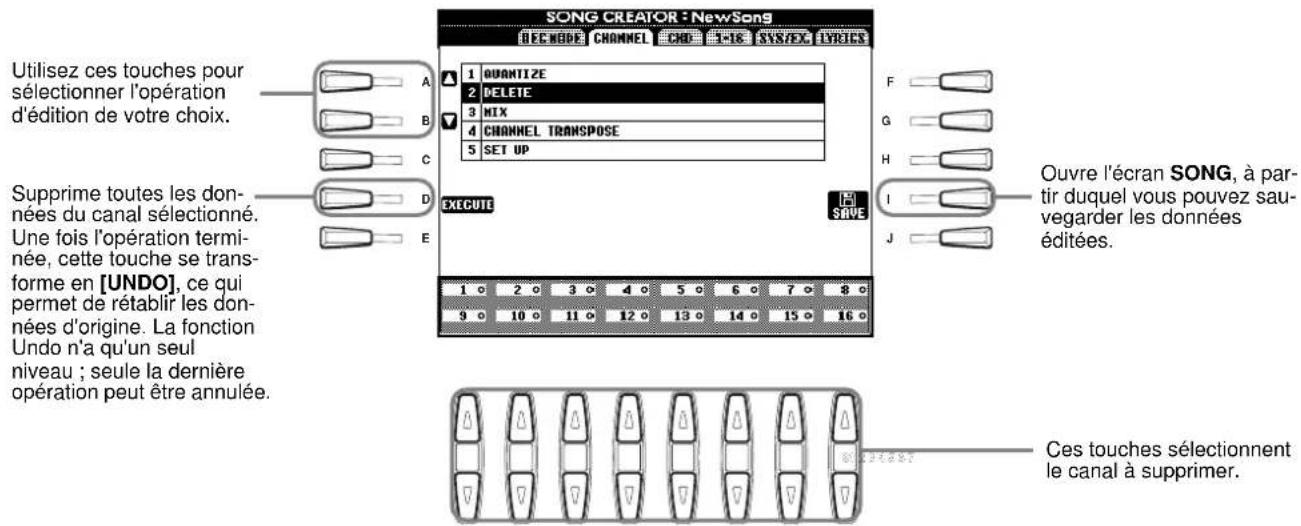 YAMAHA PSRA1000 - Delete - 1
