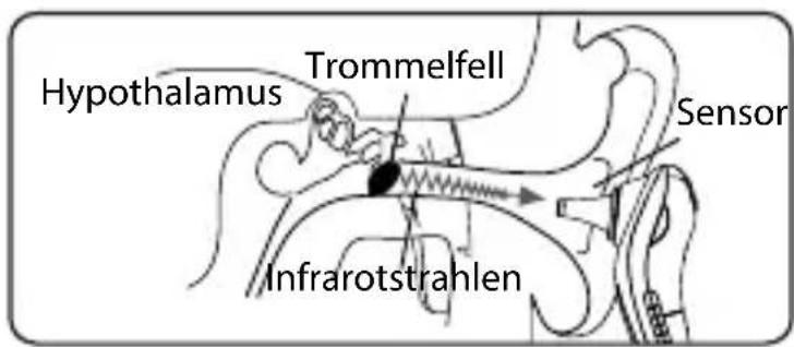 INVENTUM TMO430 - Einführung - 1