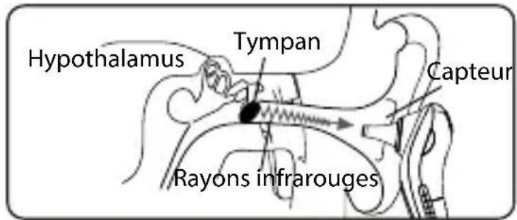 INVENTUM TMO430 - introduction - 1