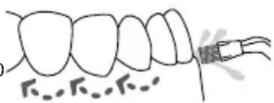 Waterpik WP950 - Beccuccio ortodontico - 2