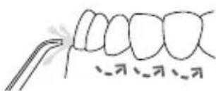 Waterpik WP950 - Empfohlene Methode - 1