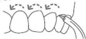 Waterpik WP950 - Subgingivalduse - 2