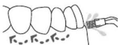 Waterpik WP950 - Plaque Seeker Tip - 1