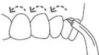 Waterpik WP950 - Embout Pik Pocket MC - 2