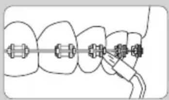 Waterpik WF05 - По завершении использования устройства - 1