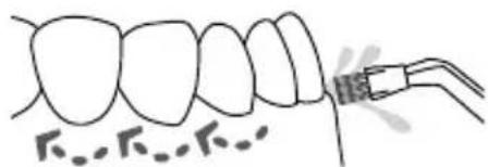 Waterpik Ultra WP112E1 - Plaque Seeker Duse - 1