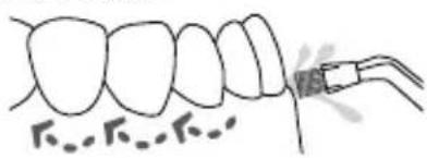 Waterpik Ultra WP112E1 - Embout Brosse à dents - 1