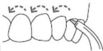 Waterpik Ultra WP112E1 - Orthodontic-Düse - 2