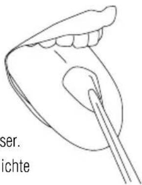 Waterpik Ultra WP112E1 - Orthodontische Tip - 2