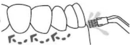 Waterpik Ultra WP112E1 - Plaque Seeker® Tip - 1