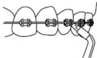 Waterpik Ultra WP112E1 - Beccuccio ortodontico - 1