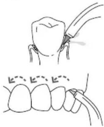 Waterpik Ultra WP112E1 - Orthodontische Tip - 1