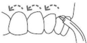 Waterpik Ultra WP112E1 - UTILISATION DE L'EMBOUT Embout Pik Pocket - 2