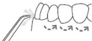 Waterpik Ultra WP112E1 - Recommended Technique - 1