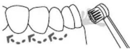 Waterpik Ultra WP112E1 - Zahnbürstenaufsatz - 1